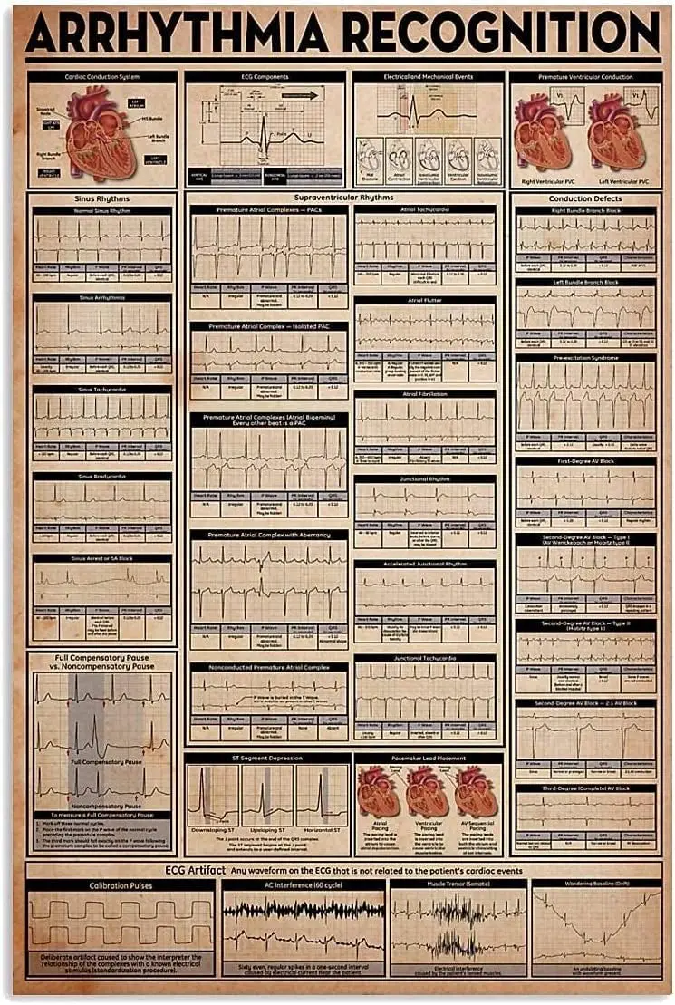 Youpinnong Panneaux métalliques sur la cardiologie, Affiches infographiques de reconnaissance des arythmies, Panneaux muraux ECG pour la maison, le club et le bureau W