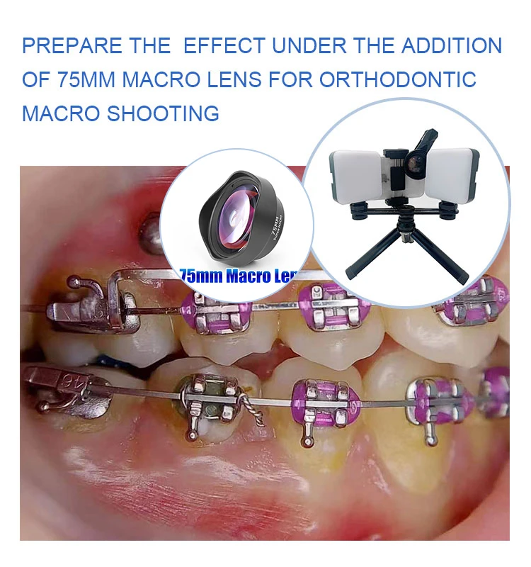 Imagem -05 - Lanterna Dentária Led com Bluetooth Odontologia Completa Luz de Enchimento Oral Foto e Vídeo Kit de Fotografia Mk017