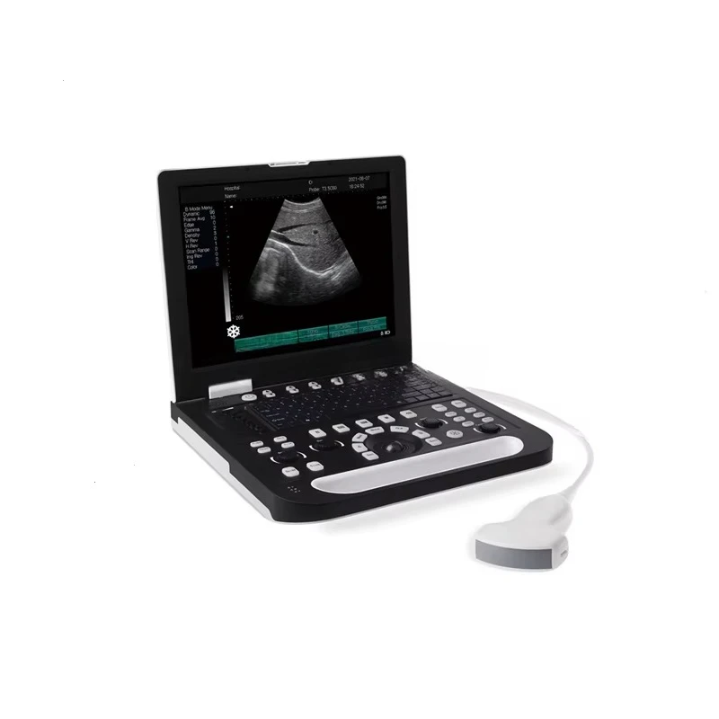 

Cow Ultrasound Instrument for Veterinary Surgical Instruments