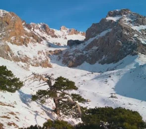 

AI Intelligent Scalp Analyzer Machine for Hair Loss Diagnosis 4 Spectrum Trichology Camera System