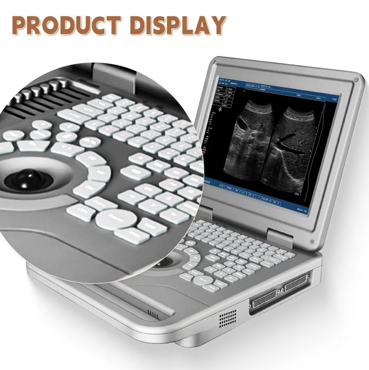 Smart F Vet Quality Black White Vet Portable Animal Ultrasound Machine Veterinary Ultrasound Pet Ultrasound Machine