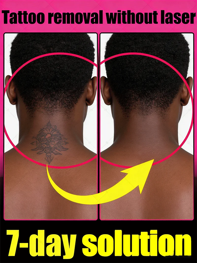 

Очиститель татуировок, глубоко осушают пигменты и осветляет короткие татуировки