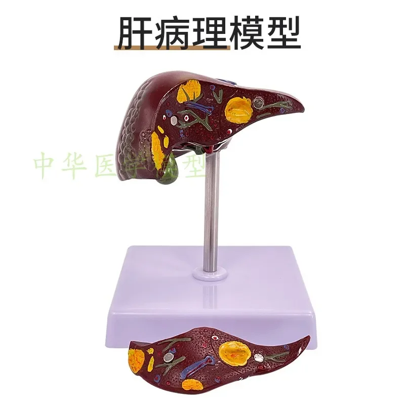 Human liver anatomy model hilar blood vessel lobe hepatic gallbladder bile duct model construction model medical teaching aids