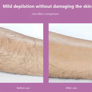 إزالة الشعر الجسدي الكريستالي ، المطاط الزجاجي ، آلة إزالة الشعر غير المؤلمة ، سهلة التنظيف ، أداة إزالة الشعر للعناية بالجسم قابلة لإعادة الاستخدام أعلى 12 مبيعات لإزالة الشعر للقضيب - رقم 8