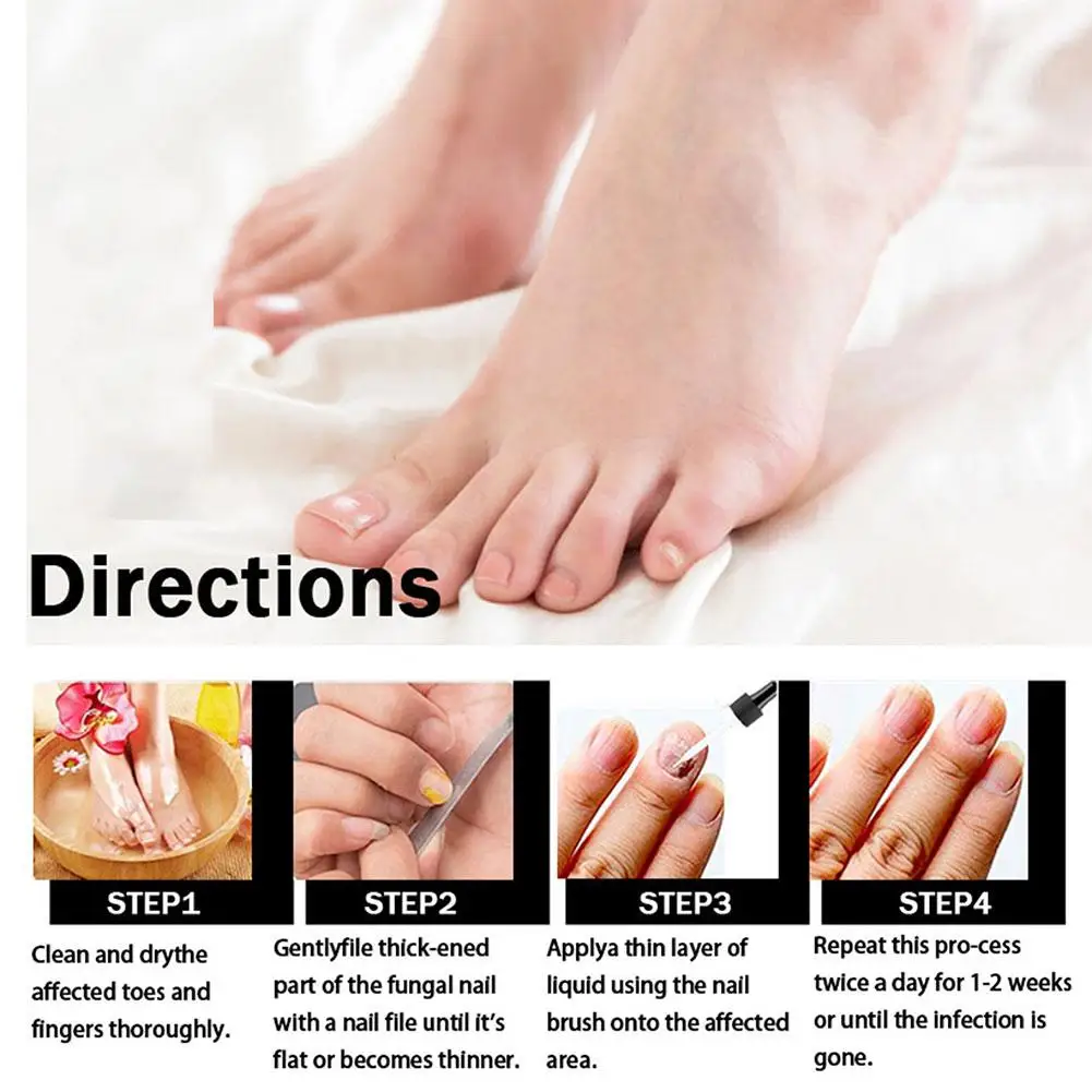 30ml Nail Repair Solution Nail Repair Essence Remove Onychomycosis Serum Fungal Nail Treatment Essence Nail Liquid Care
