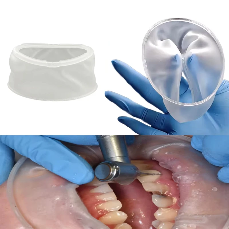 10/20Pcs Dental Rubber Mouth Opener Disposable Cheek Retractors Orthodontic Oral Lip Cheek Retractor O Shape Expander Dentistry