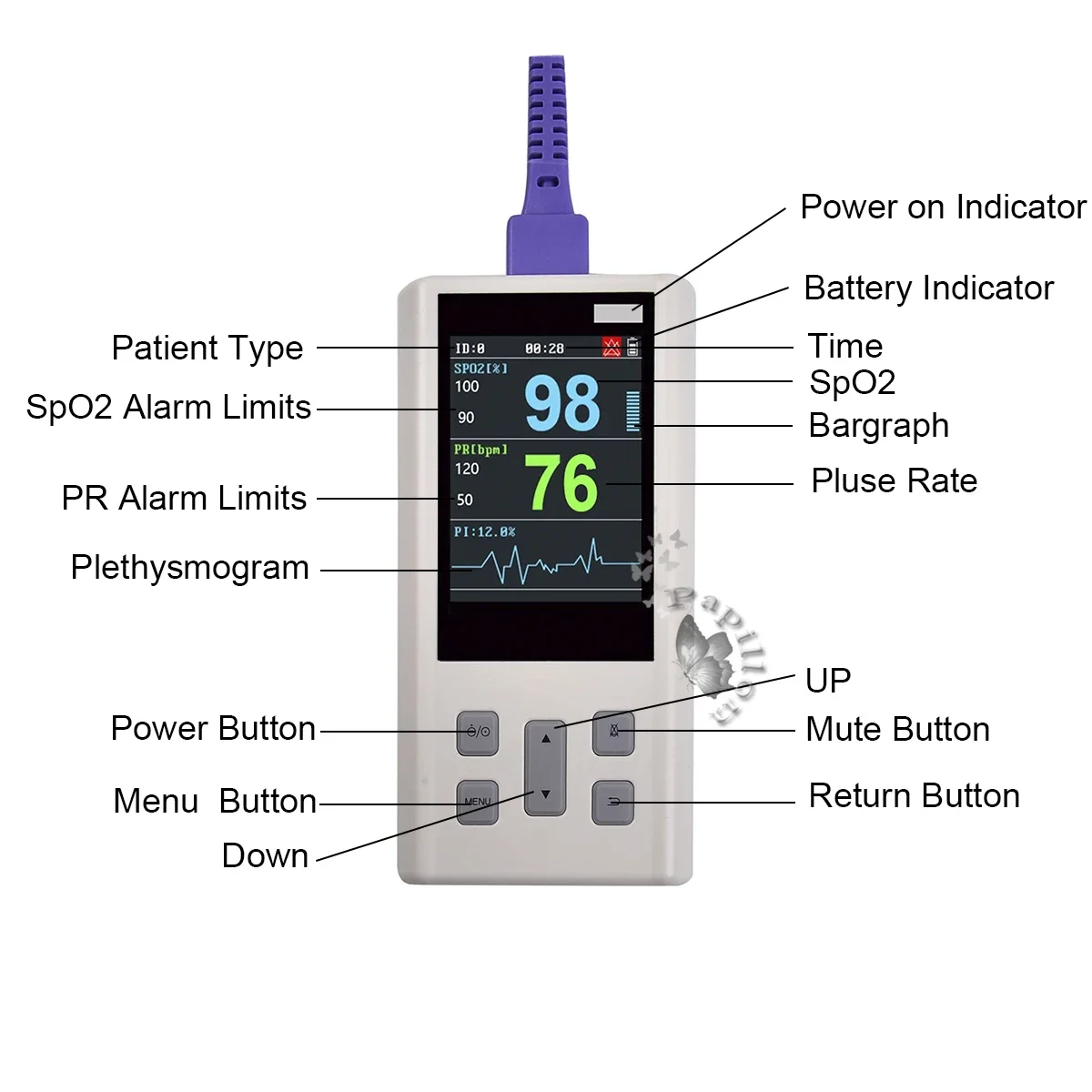 Handheld Pulse Oximeter Veterinary Vital SPO2 PR PI Heart Rate Monitor With Memory Adult Neonatal Pets Hospital clinic household