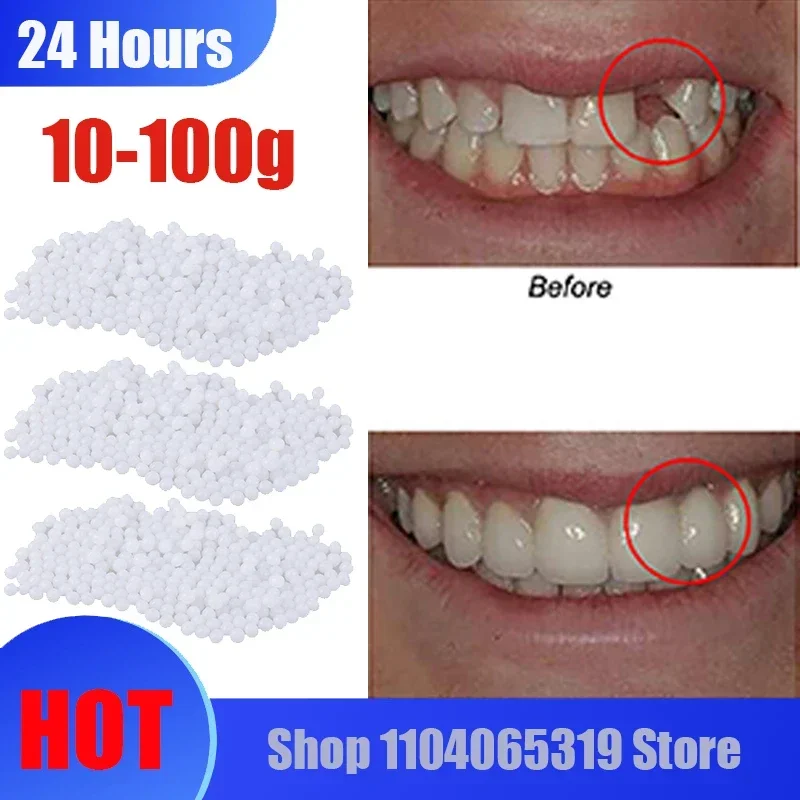 

10 г-100 шт./пакет, комплект для ремонта зубов, термобусины для заполнения, исправление отсутствующего и сломанного зуба или клея для протеза, искусственные зубы 2026