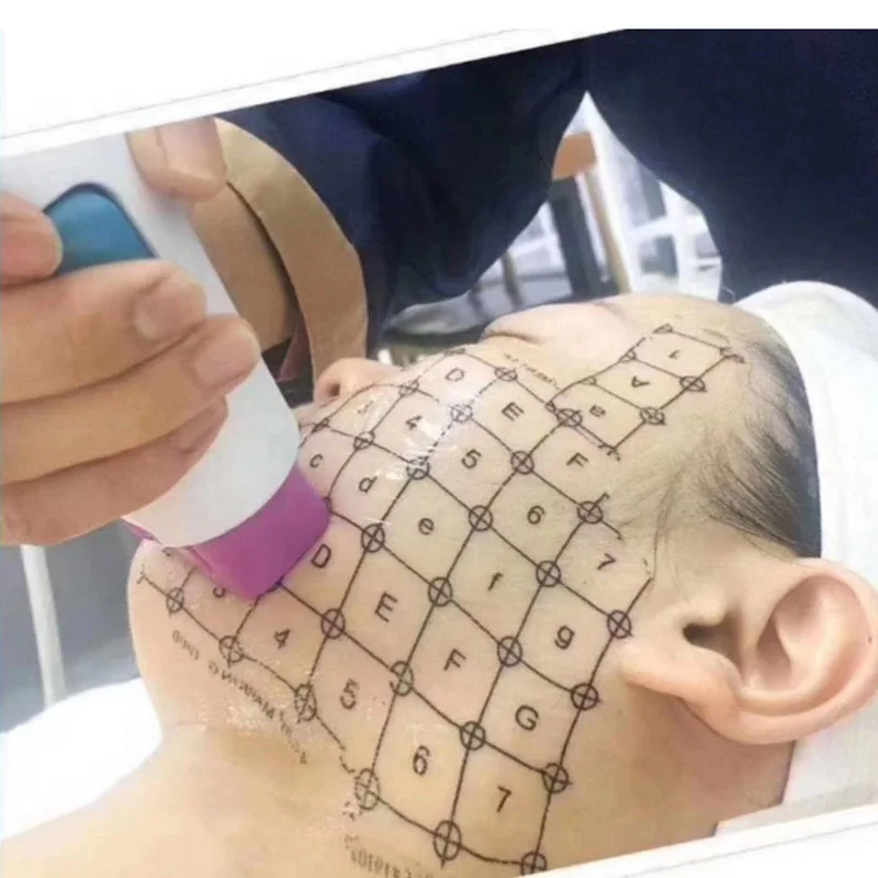 

Grid RF Machine Face Skin Marking Paper