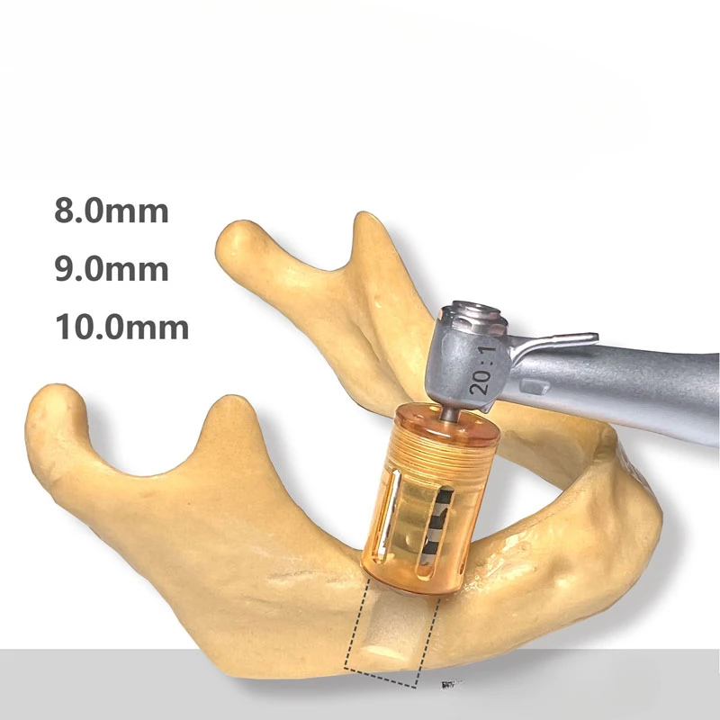 

Dental Implant SLT Half Moon Bone Drill Implant Ring Drill Used for Incremental Bone Implantation Surgery To Extract Flake Bone