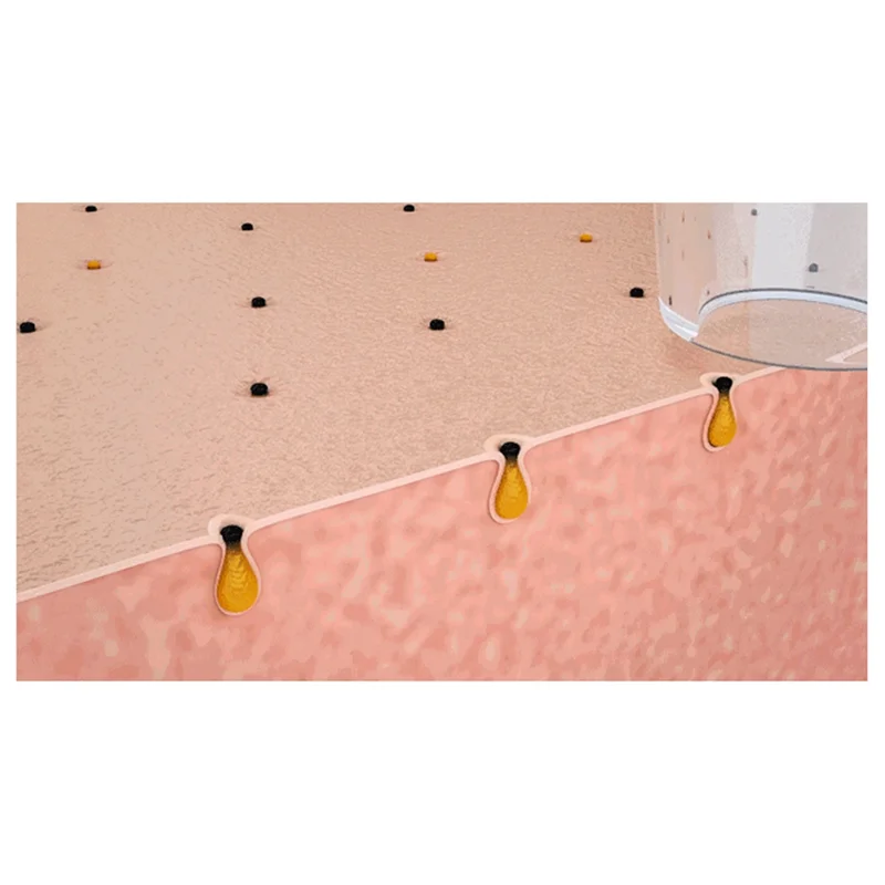 A05G-Blackhead Sucker Deep Clean Machine Heating Type Acne Remover Blackheads Heated Face