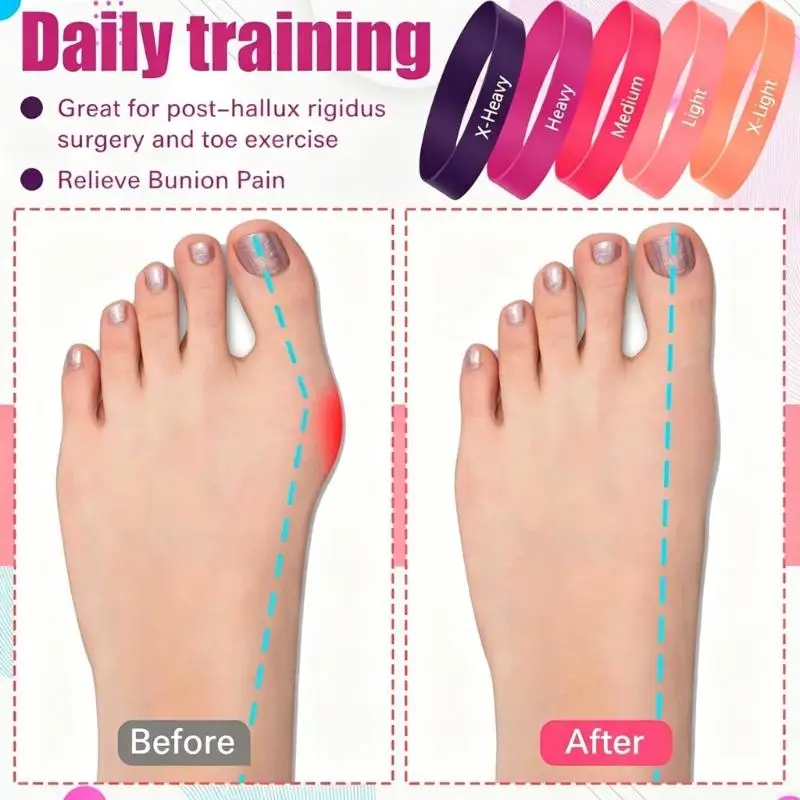  Toe Resistance Band Set of 5 Elastic Stretch Rings for Daily Foot Exercise