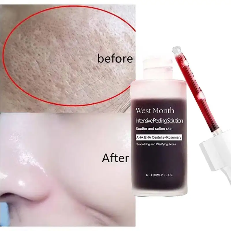 

Remove Large Pores Serum Salicylic Acid Facial Pore Shrinking Tightening Pore Minimizing Firming Smooth Essence Korean Skin Care