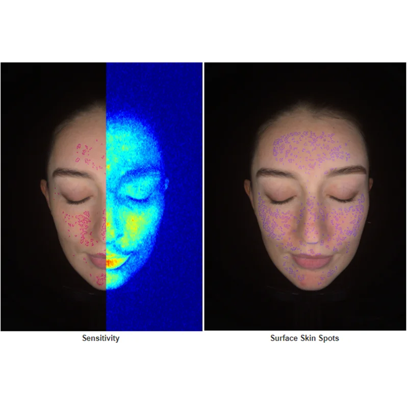 Pele Facial Detectar Máquina, Scanner 3D para Salão De Beleza