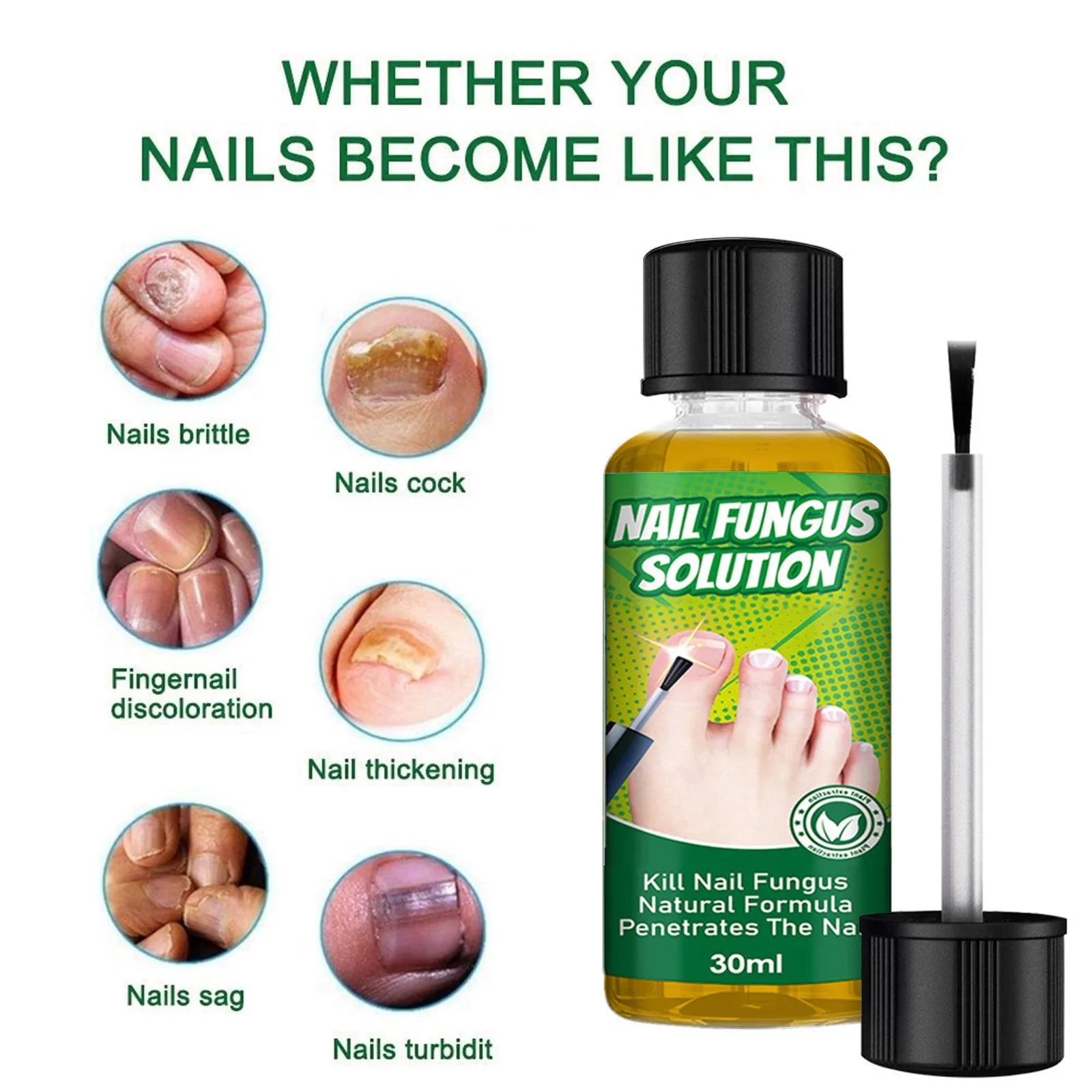 30ml Toenail Fungus Care, FastActing Nail Care Liquid For Fungus Under & Around Restores The Healthy Appearance Of Nails