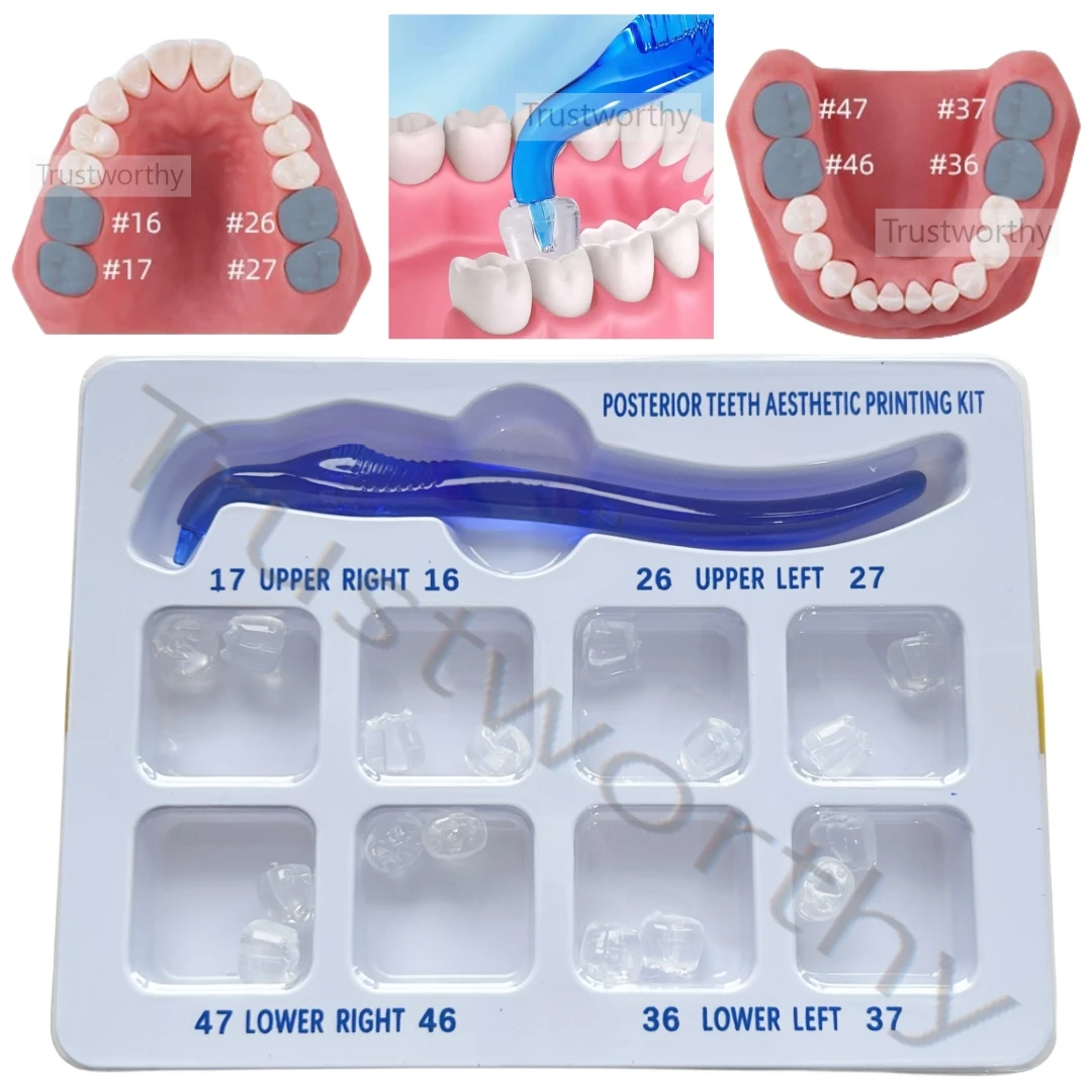 

17Pcs/Box Dental Posterior Teeth Aesthetic Printing Mould Kit For Light Cure Composite Restoration Filling Tools