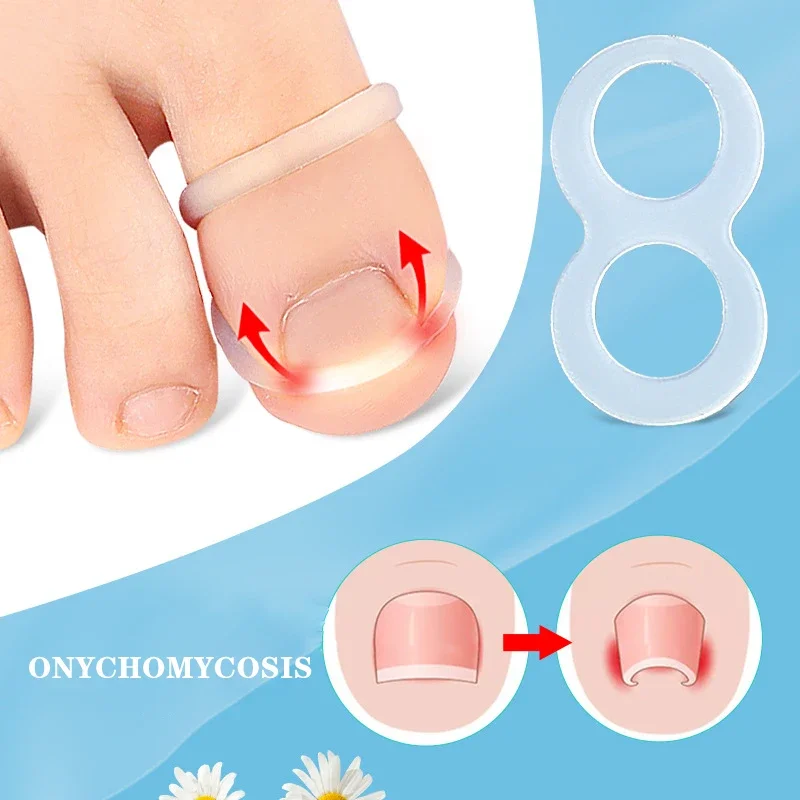 Outil de Correction des ongles incarnés en Silicone, Invisible, redressage des ongles incarnés, attelle de protection, pédicure, outils de soins des pieds