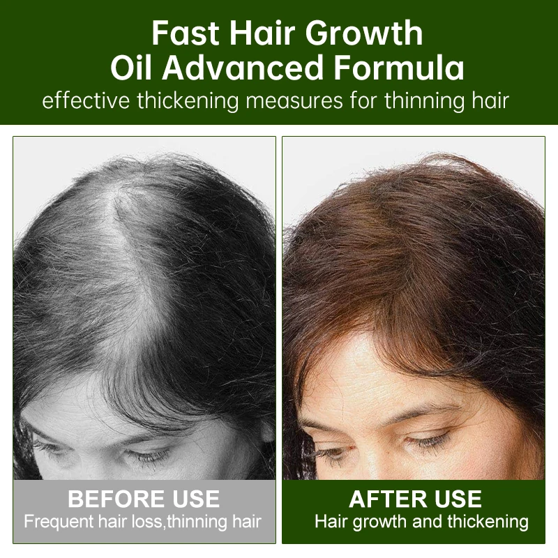 PURC Rosemary Oil Hair Care Serum Ginger Anti Hair Loss Thicken Care Strengthens Weak Hair Strands Scalp Treatments Products