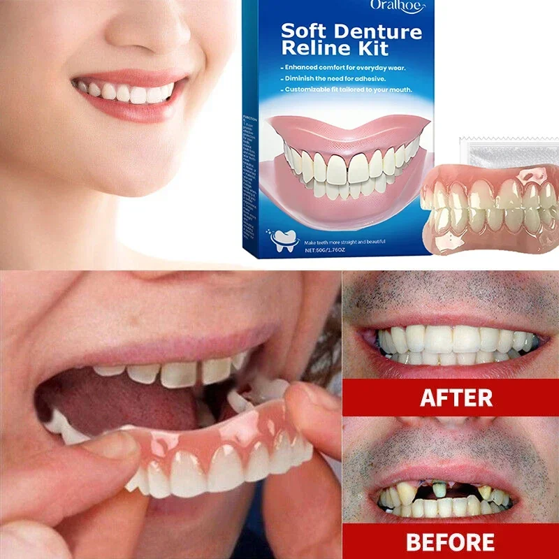 66Silicone Upper Lower Veneers – Comfortable False Teeth, Perfect Smile for Men & Women ck848