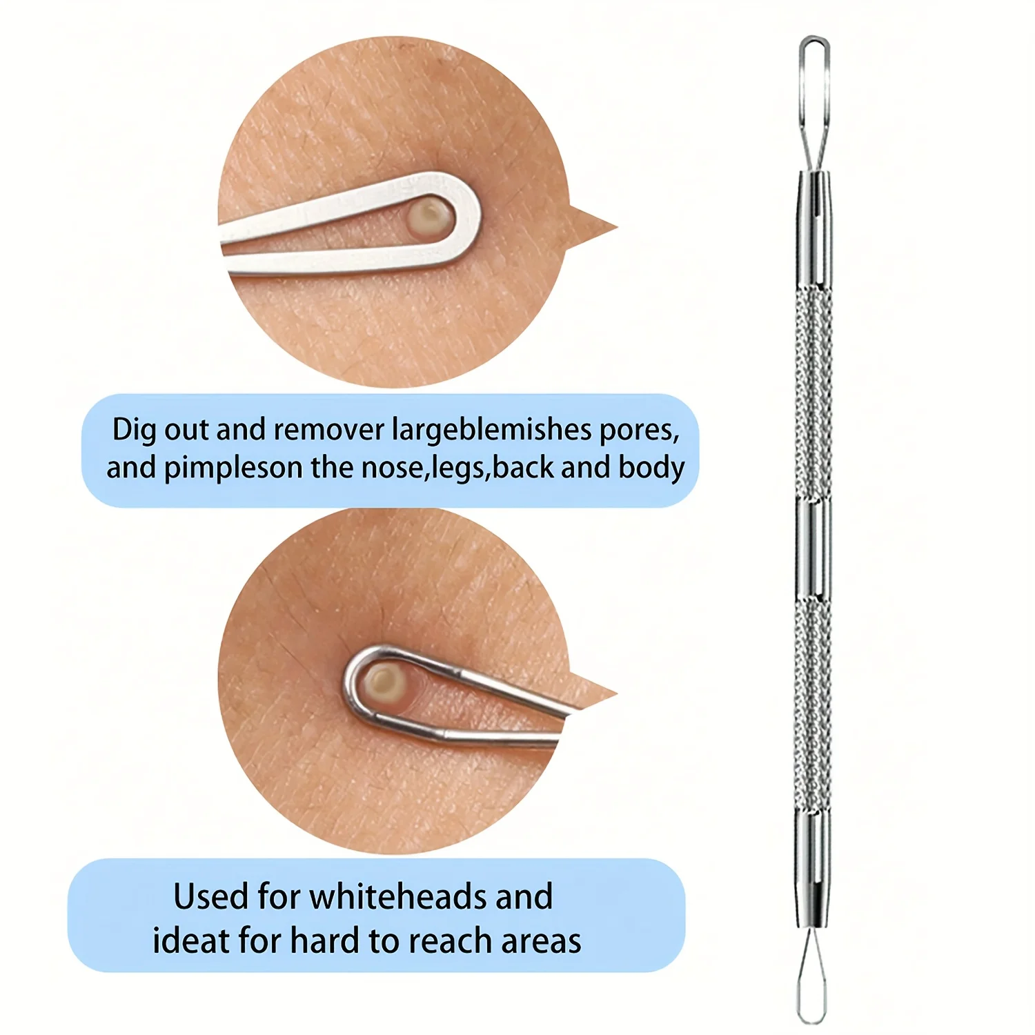 ملاقط الرؤوس السوداء لحب الشباب الخلوية فائقة النعومة - أدوات إبرة حب الشباب لإزالة جمال الوجه للعناية بالبشرة وإزالة الرؤوس البيضاء