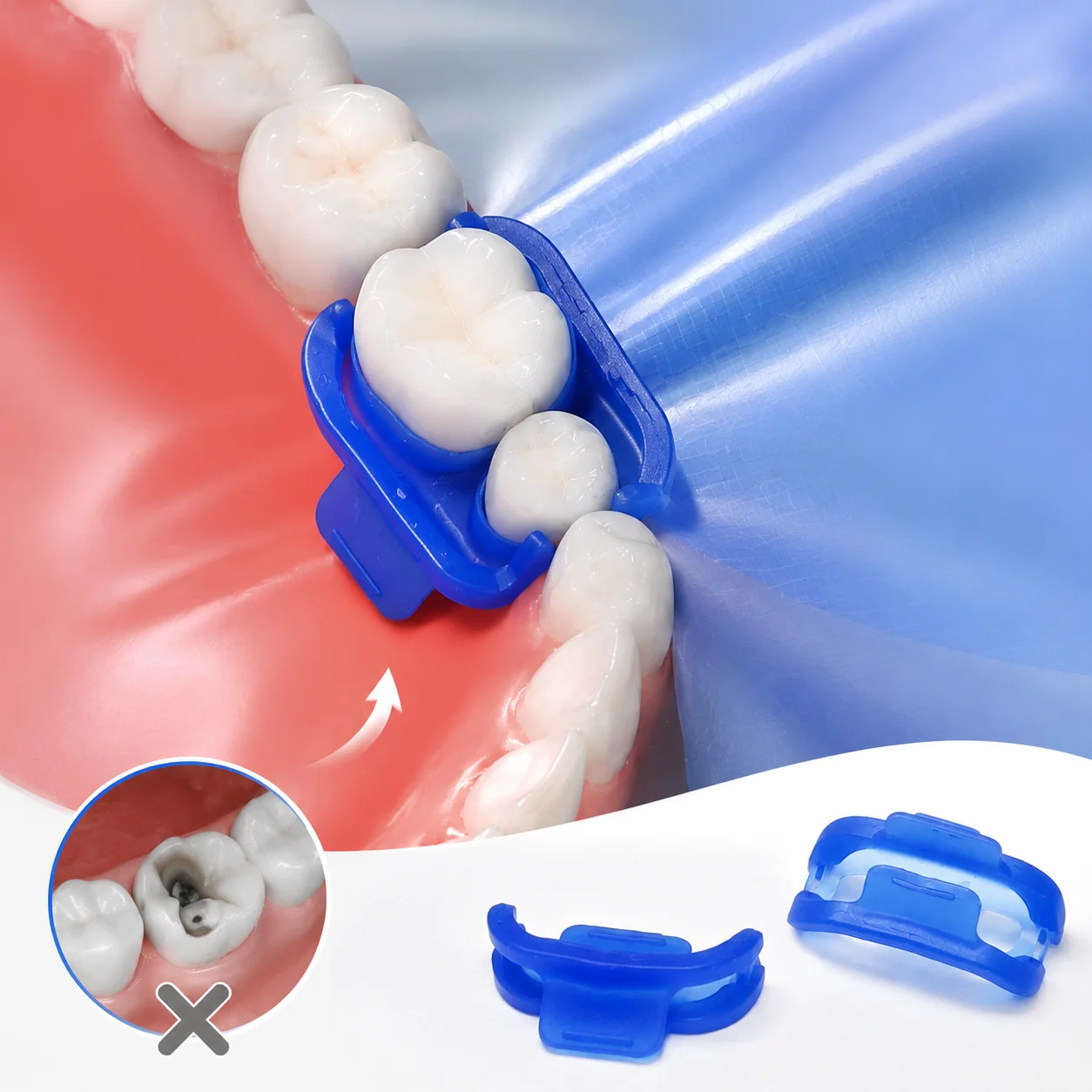 Dental Rubber Dam Clamp Holder Silicone Mini Teeth Matrix Isolator Autoclavable Reusable Clip for Pro Dentist Clinic Tool 5Pcs