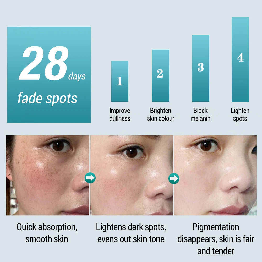 Whitening Freckle Cream Anti-freckle Moisturizing Brightening Skin Remove Dark Spot Improve Dull Facial Cream Face Care