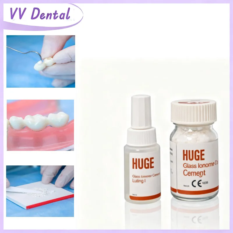 vv-デンタル-グラスアイオノマーセメント-ボンディングタイプ-ルーティング-エクストラストロング-義歯接着剤-グラスセメント-30g-パウダー-25g-液体剤
