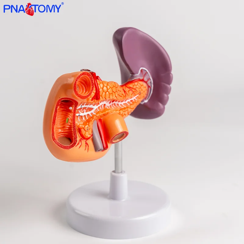 

Spleen Pancreas Duodenum Spleen Pancreas Gallbladder Duodenum Model