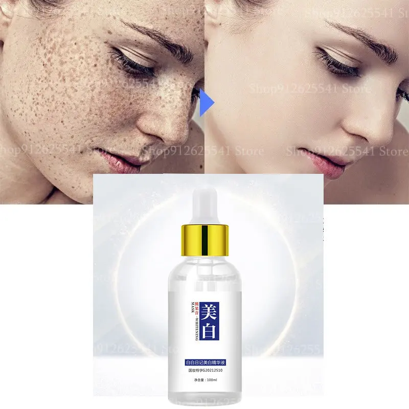 

Effective Whitening Serum Freckle Essence Anti-Aging Niacinamide Remover Black Spot Serum Fade Pigmentation Melasma Brighten