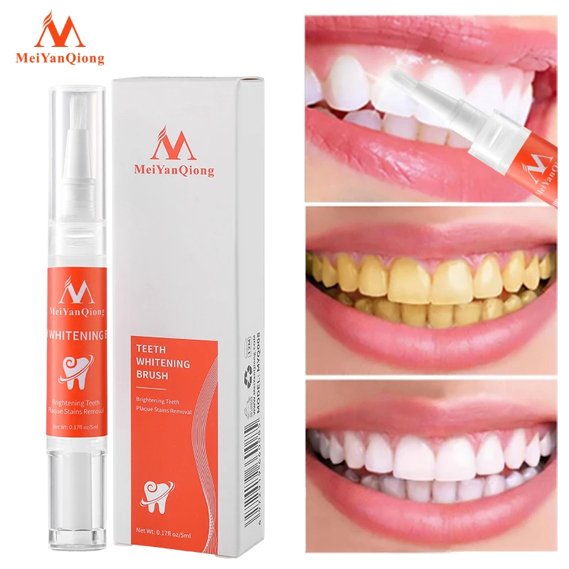 

Teeth Whitening Pen Stain Removal Teeth Brighten Tooth Whitening Products Yellow Teeth and Plaque Removal Oral Cleaning