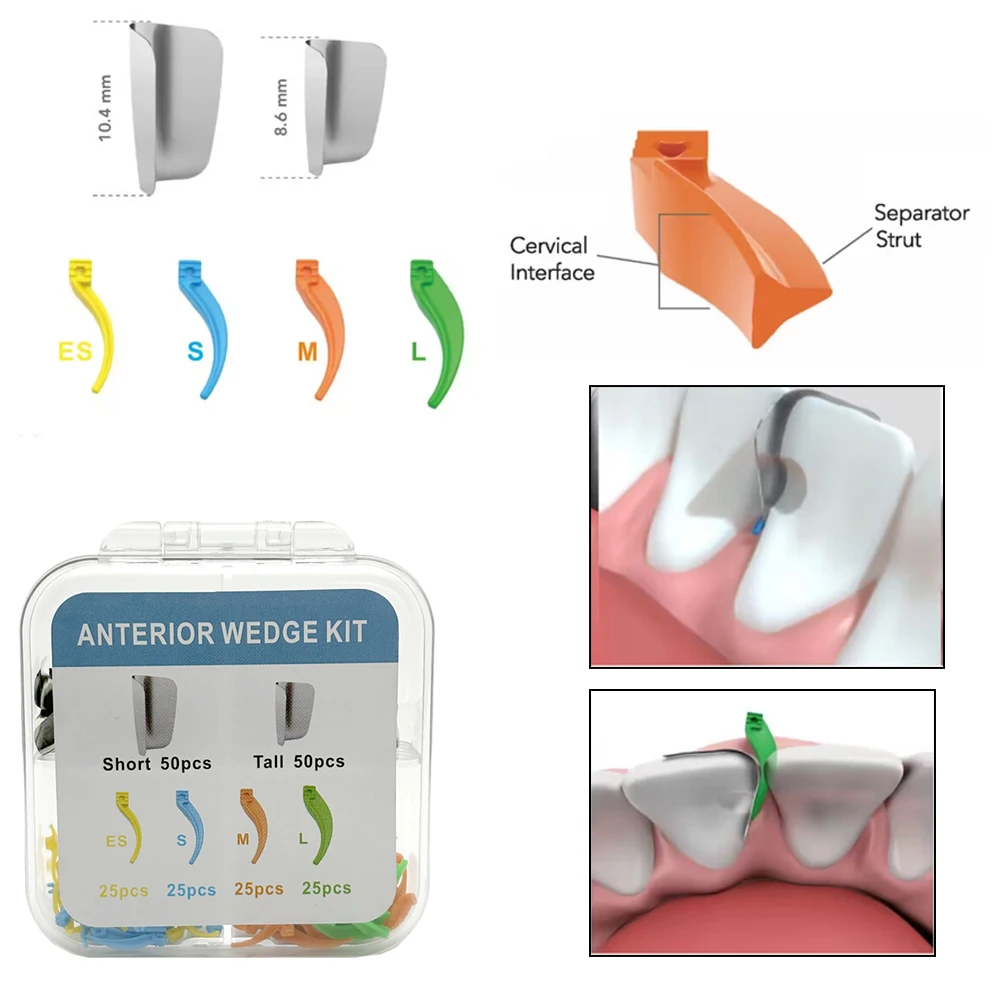 

High-Quality 200Pcs Dental Wedges & Matrix Bands - Anterior Matrix System for Dentists Essential Oral Care Supplies