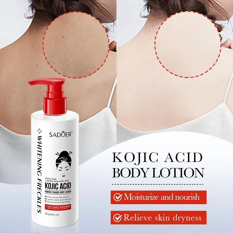 Acid Body Lotion 250g Brightening Moisturizing Cream Dark Spot Corrector Even Skin Tone Body Butter Nourishing Skin Care