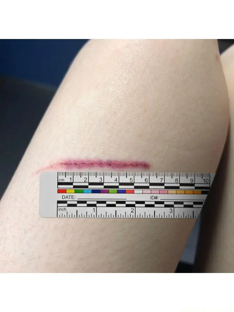 A2BE Single Use 10cm Adhesive Skin 100pc Roll Grade Wound Assessment Device