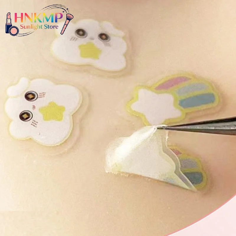 20pcs Cute Cloud Shaped  Treat - Skincare Acne recension och pris