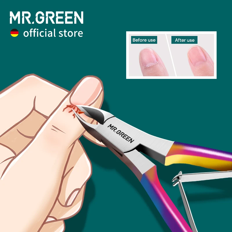 MR.GREEN Gorgeous Colorful Cuticle Nippers Cuticle Clippers Nail Manicure Scissors Trimmer Dead Skin Remover Stainless Stee Tool