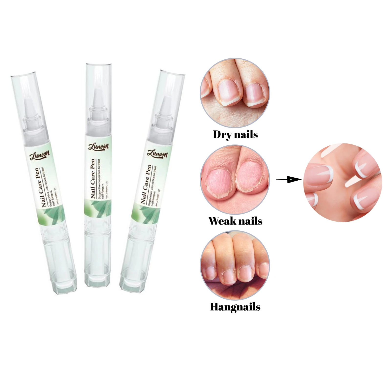 3 Stuks Nagelverzorging Pen Voor Droge Zwakke Nagels & Hangnagels Behandeling Nagel Reparatie Versterker Nagelriemolie Pen Voedingswaarde nagelgroei