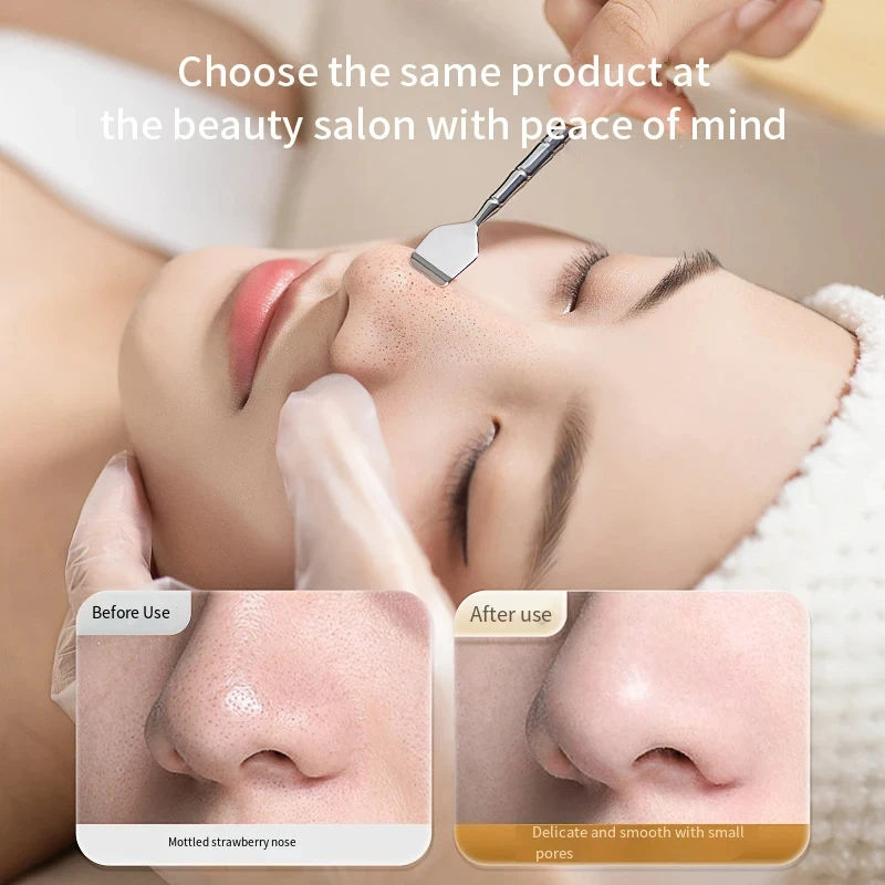 2 In 1 Professional Blackhead Remover ไม้พายจมูก Blemish Pore CLEANER Beauty Face Health Salon พิเศษ Remover สิวเครื่องมือ