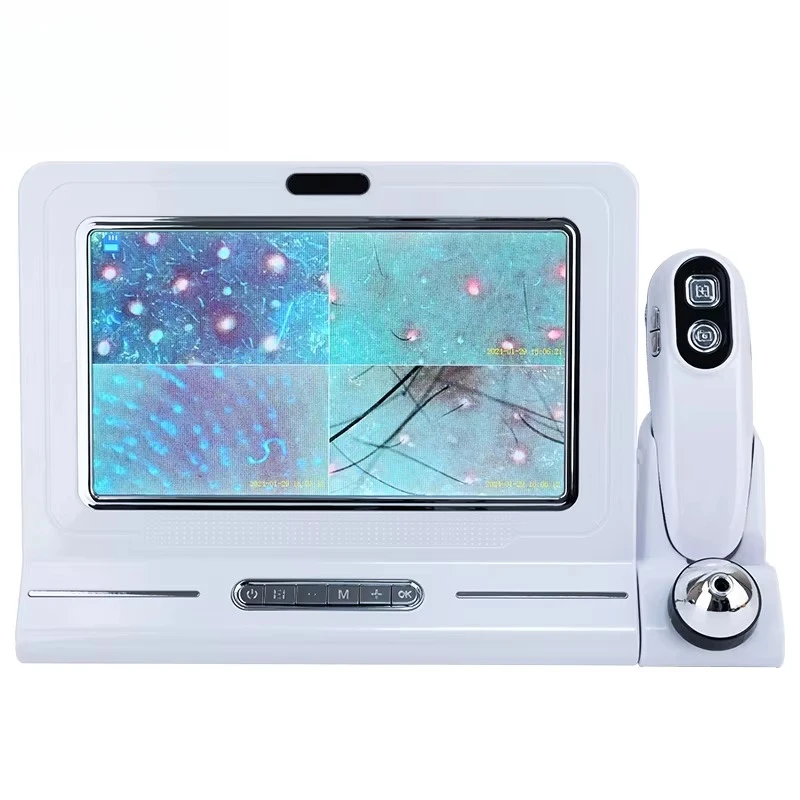 Portable Salon Hair Analyzer, Scalp Scanner, Hair Analysis Machine, Professional Skin Detection Tool