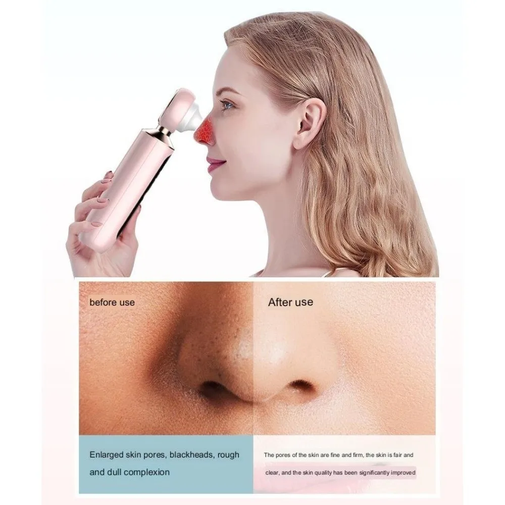 Removedor Elétrico de Cravos e Espinhas, Limpador de Poros Facial, Instrumento Portátil de Remoção de Cravos com LED
