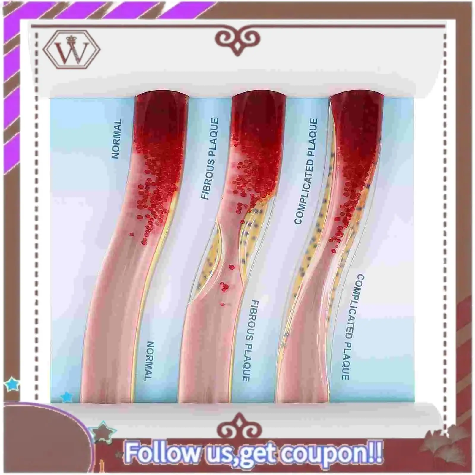 

ABBG-Dynamic Blood Vessel Model Cardiovascular Blockage Contrast Model Thrombosis Model For Teaching Explanation