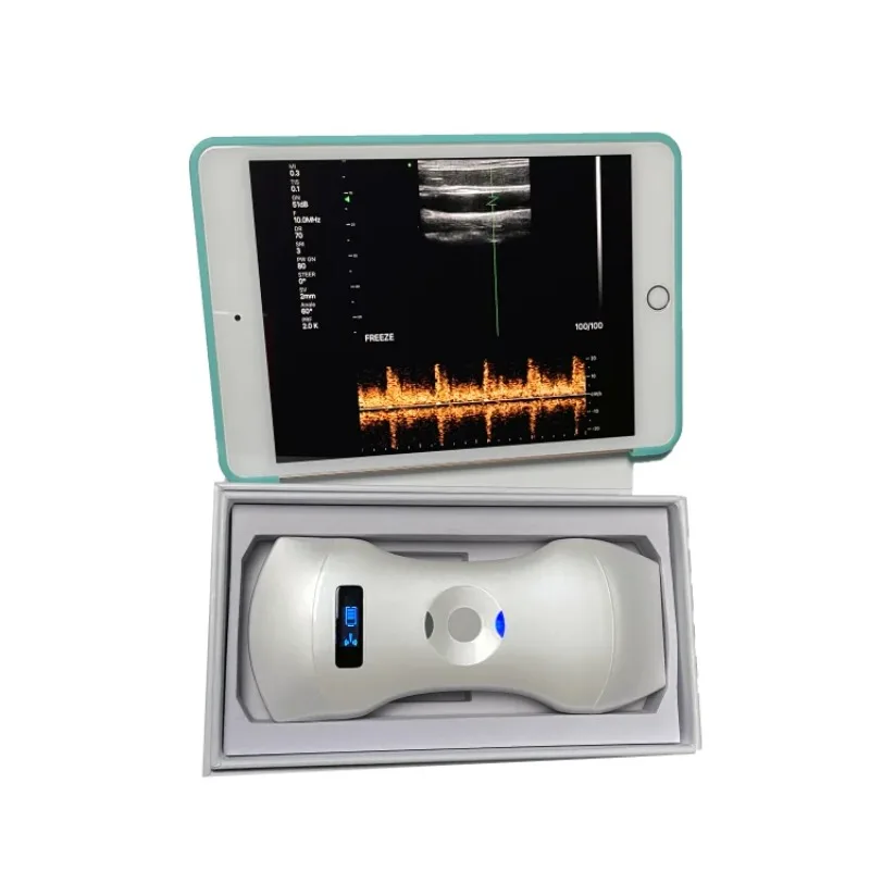 Wireless Double Convex Transparent Portable Three in One Color Doppler Ultrasound Detection Machine