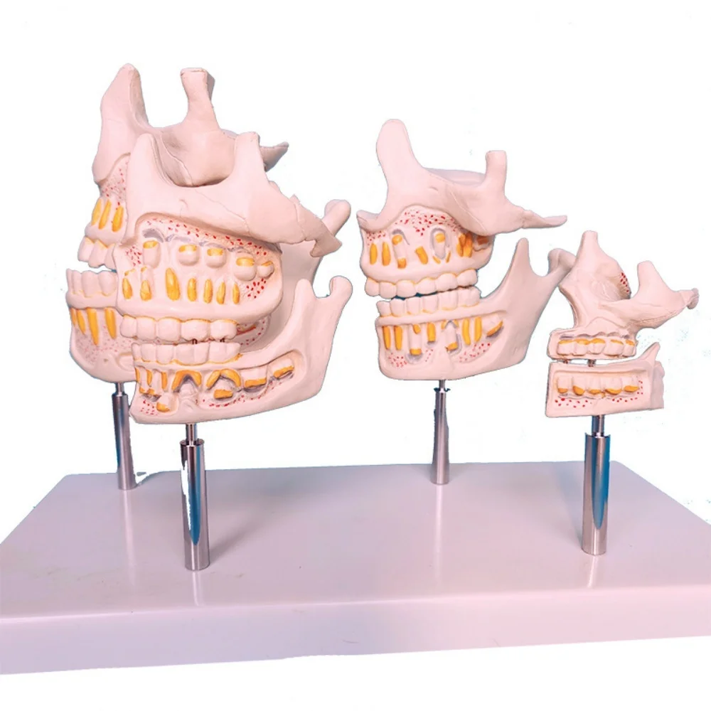 

Медицинская модель мандибулярной анатомии человеческого бионического зуба