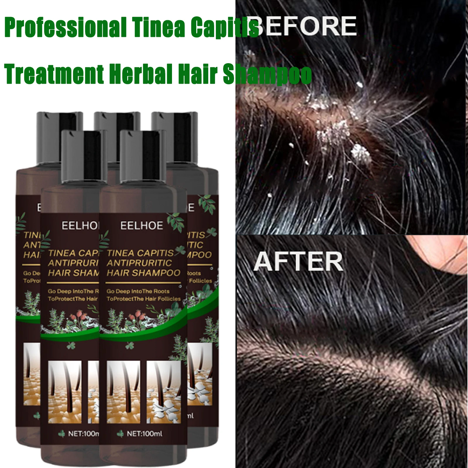 

Natural Herbal Hair Shampoo Deep Nourish Moisturize Scalp Care Hair Washing Lotion Professional Anti Dandruff Remove Mites