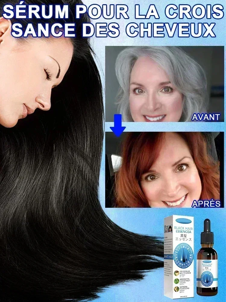 Anti-Grey cabelo soro tratamento, restaurar, impedir o cabelo, nós branco, Ahair em preto, saudável, cor natural