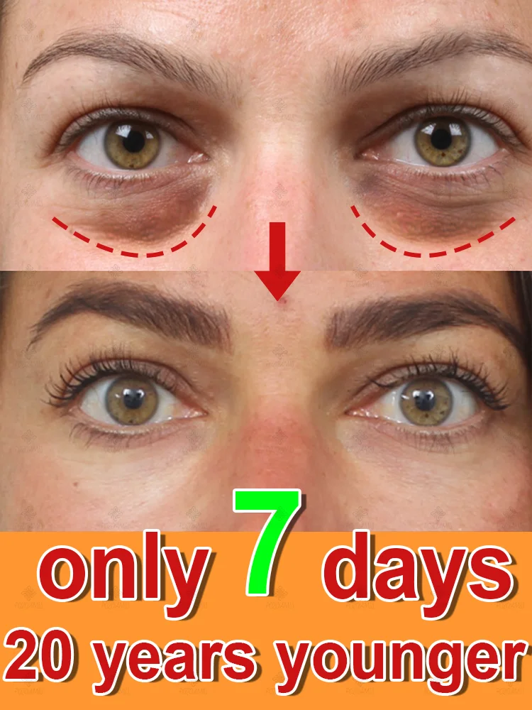 

7 days to make you 20 years younger