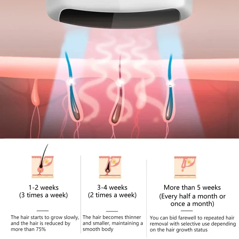 Xiaomi Mkboo เลเซอร์กำจัดขน IPL Photon Rejuvenation Professional กำจัดขนถาวรกำจัดขนเต็มรูปแบบและเส้นผม R