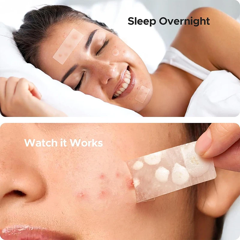 208 Adesivos Invisíveis de Hidrocoloide para Acne, Impermeáveis e Respiráveis, para Cuidados com a Pele, Adesivos Faciais para Espinhas e Manchas