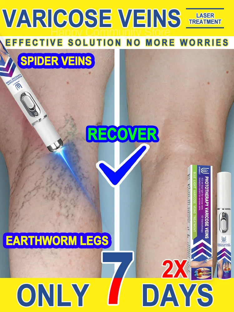 

Laser Therapy For Blue Light Pen