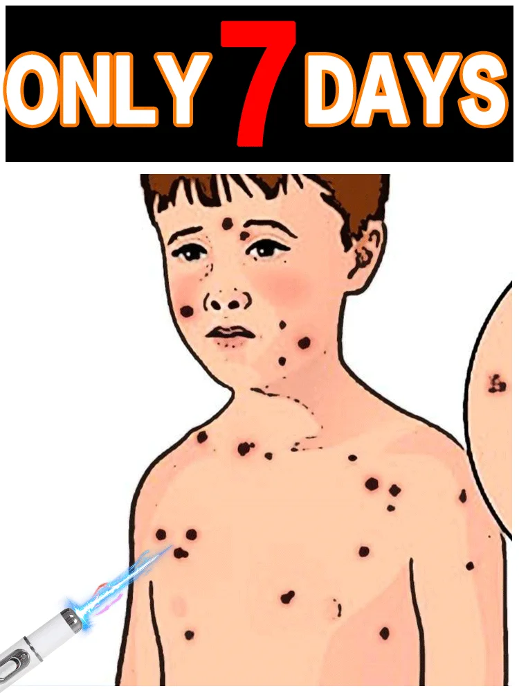 

Quickly eliminate warts and restore healthy skin.