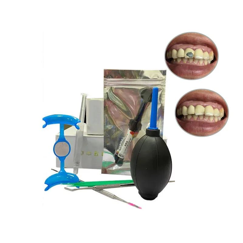 

Teeth Notch Damage Repair Kit Repairing Teeth Gaps, Loose Teeth,Denture Fill Repair Resin Bonding, Fixing Adhesive Long-Lasting